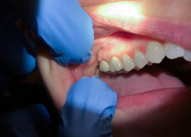 Best Weekend Emergency Dentist in Mount Ida, AR